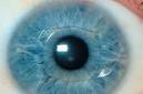 Verisyse lens inside the human eye